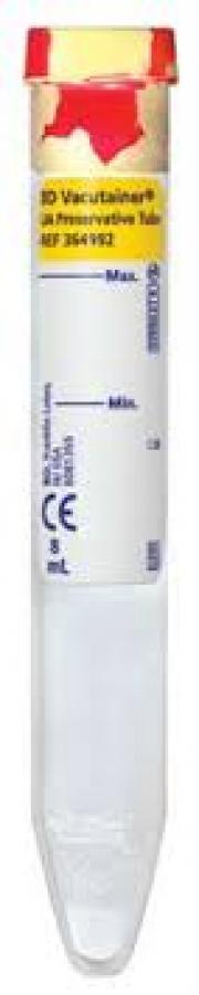 BD Vacutainer Urinalysis Tubes, Conventional Closure, 16 x 100 mm ...