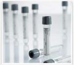 Greiner Bio-One VACUETTE Venous Blood Collection Tube