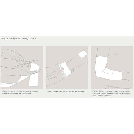 Molnlycke Tubifast Tubular Retainer Dressing